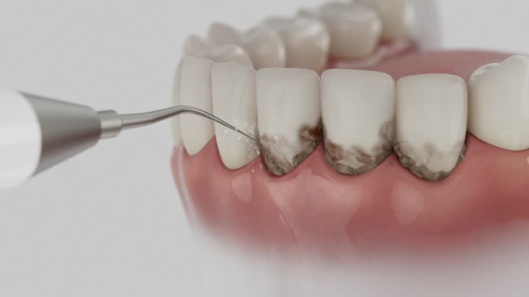 Trusted Teeth Cleaning And Checkup service in Wise, VA - Dentist Open Now